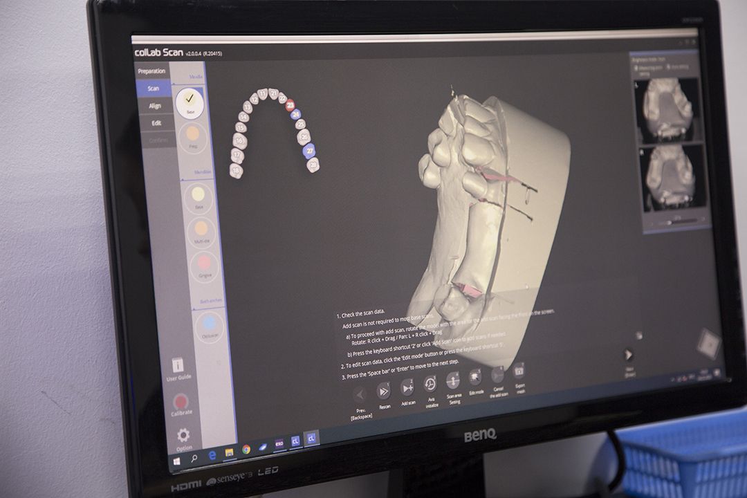 Зуботехническая лаборатория «Dental Hub»5.jpg