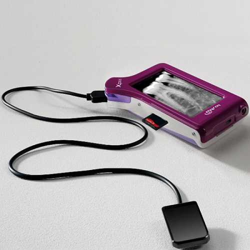 MyRay X-pod - беспроводная цифровая радиовизиографическая система