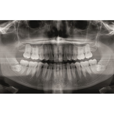 KaVo Pan eXam Plus 2D - датчик для панорамной рентгенодиагностики