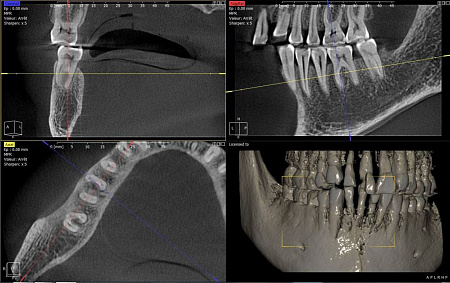 Owandy I-Max Touch 3D – Конусно-лучевой томограф 9х8