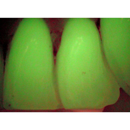 Durr Dental VistaCam IX – интраоральная видеокамера с системой сменых насадок CAM, Proof