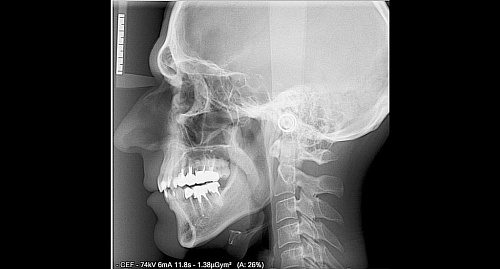 Owandy I-Max Touch 3D – Конусно-лучевой томограф 9х8