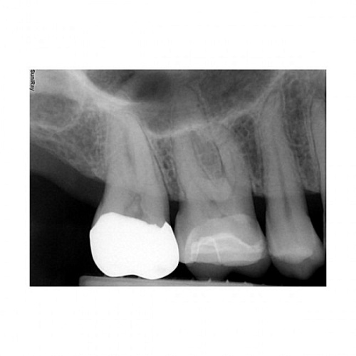 Suni SuniRay2 - система компьютерной радиовизиографии