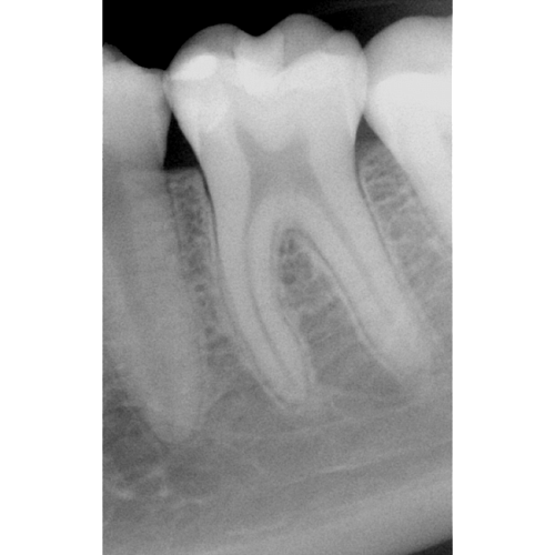 Suni Dr.Suni Plus - система компьютерной радиовизиографии