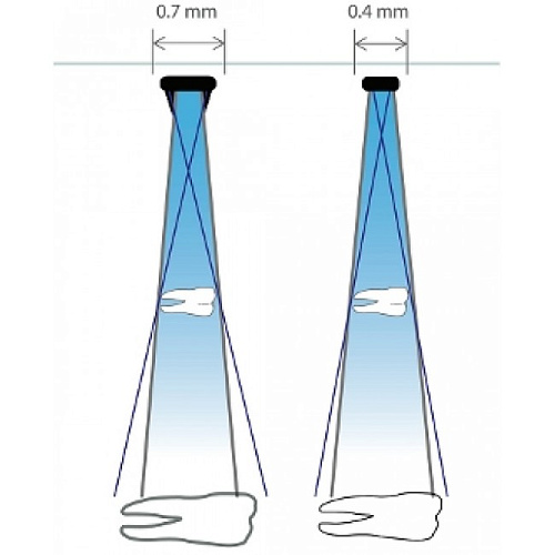 Progeny Preva DC - интраоральный рентген (настенная версия)