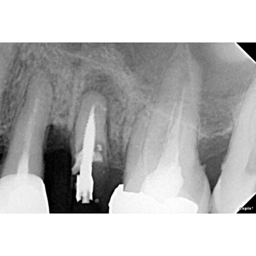 Acteon SAG SOPIX2 - система компьютерной визиографии (стоматологический визиограф)